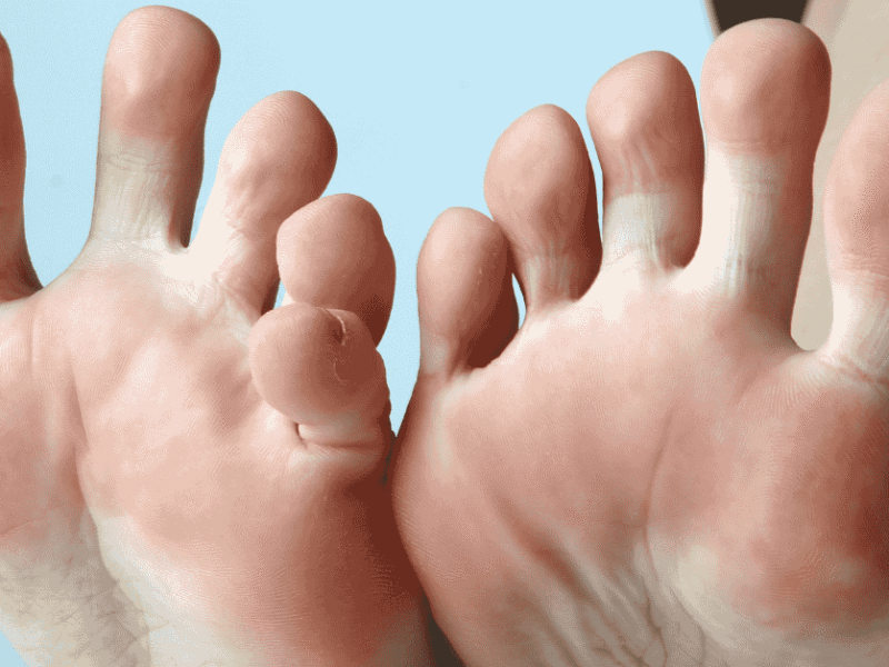 Top 10 Foot Care Tips for Active Adults