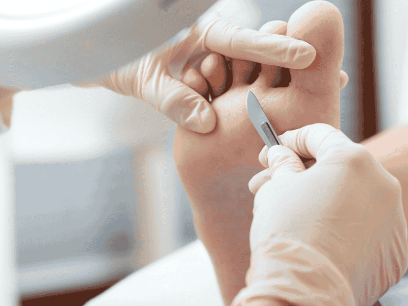 Top 5 Foot Problems in Phoenix, AZ – and How a Local Podiatrist Can Help Top 5 Foot Problems in Phoenix, AZ – and How a Local Podiatrist Can Help