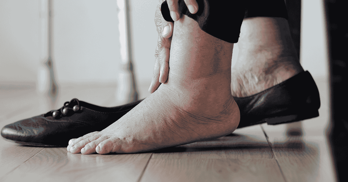 When Your Ankles Talk Back: What That Swelling Really Means