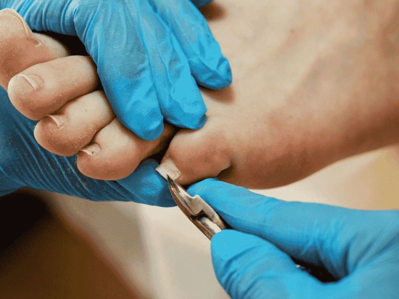 How Advanced Foot & Ankle Care Can Help You Avoid Surgery—and Recover Faster When You Need It