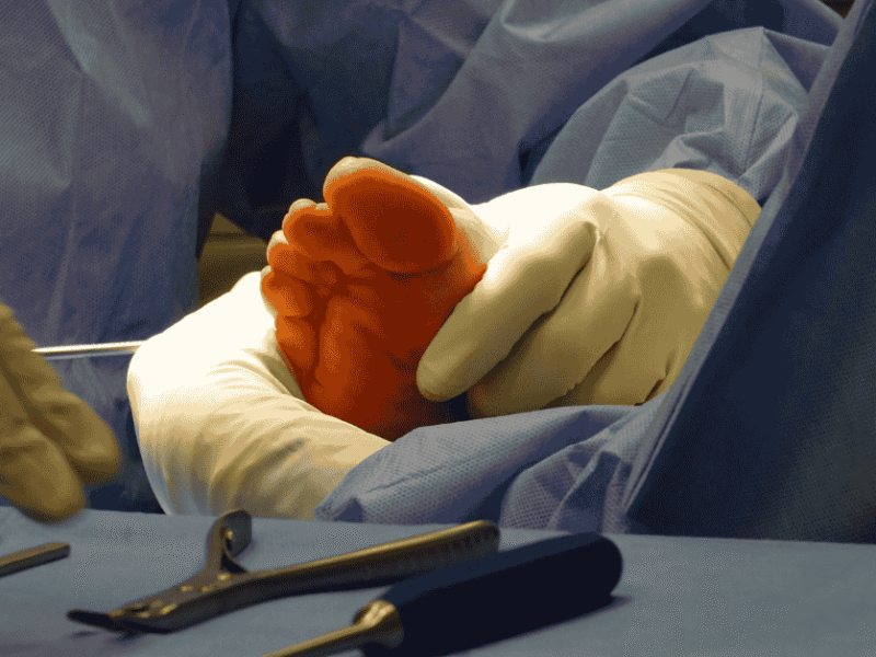 How Advanced Foot & Ankle Care Helps You Avoid Amputations and Protect Your Mobility