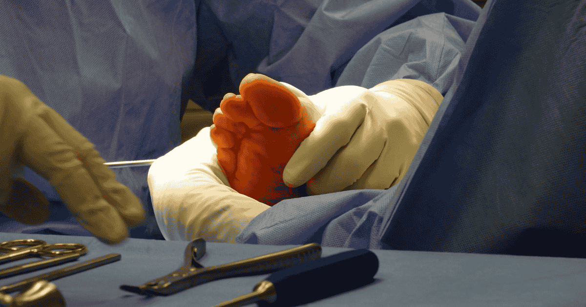 How Advanced Foot & Ankle Care Helps You Avoid Amputations and Protect Your Mobility