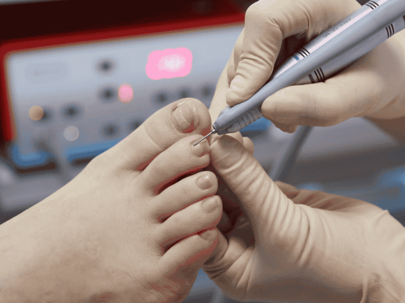 From Ingrown Toenails to Chronic Pain: What a Podiatrist Treats (and When to Go)