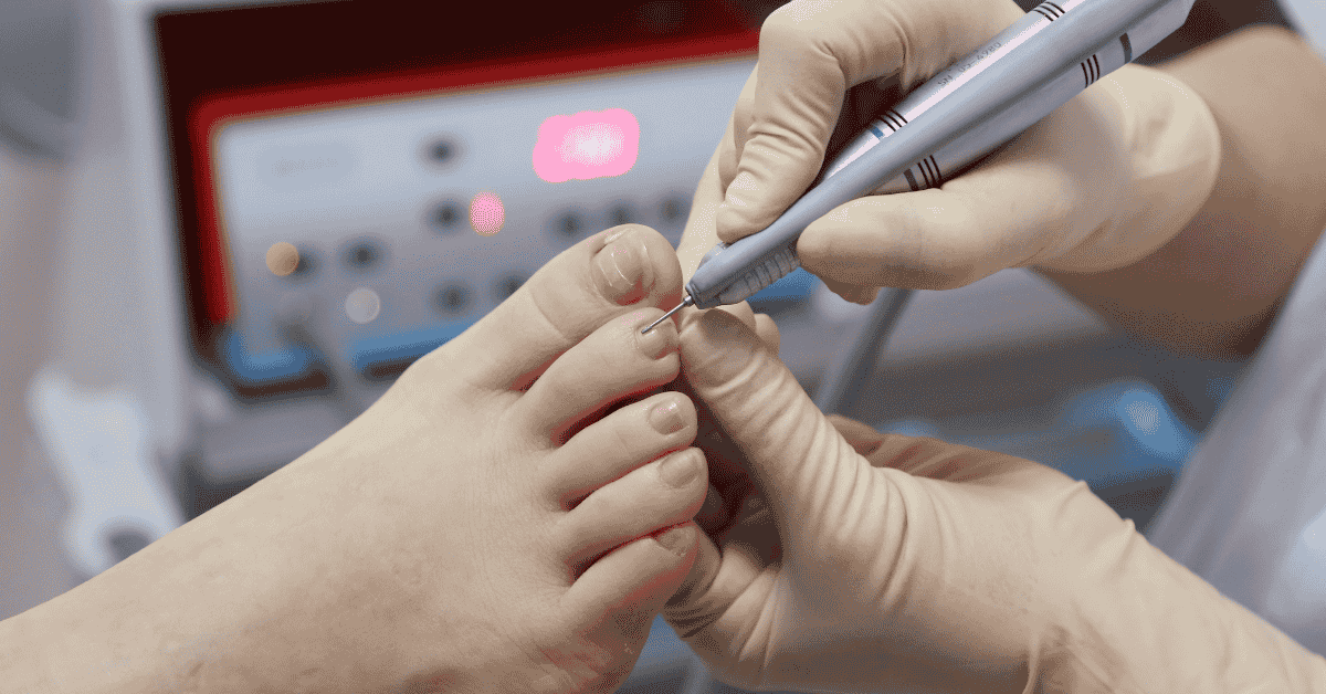 From Ingrown Toenails to Chronic Pain: What a Podiatrist Treats (and When to Go)