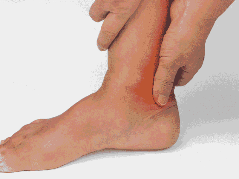Why Your Heel Pain Isn’t “Just Plantar Fasciitis” — And What It Could Actually Be