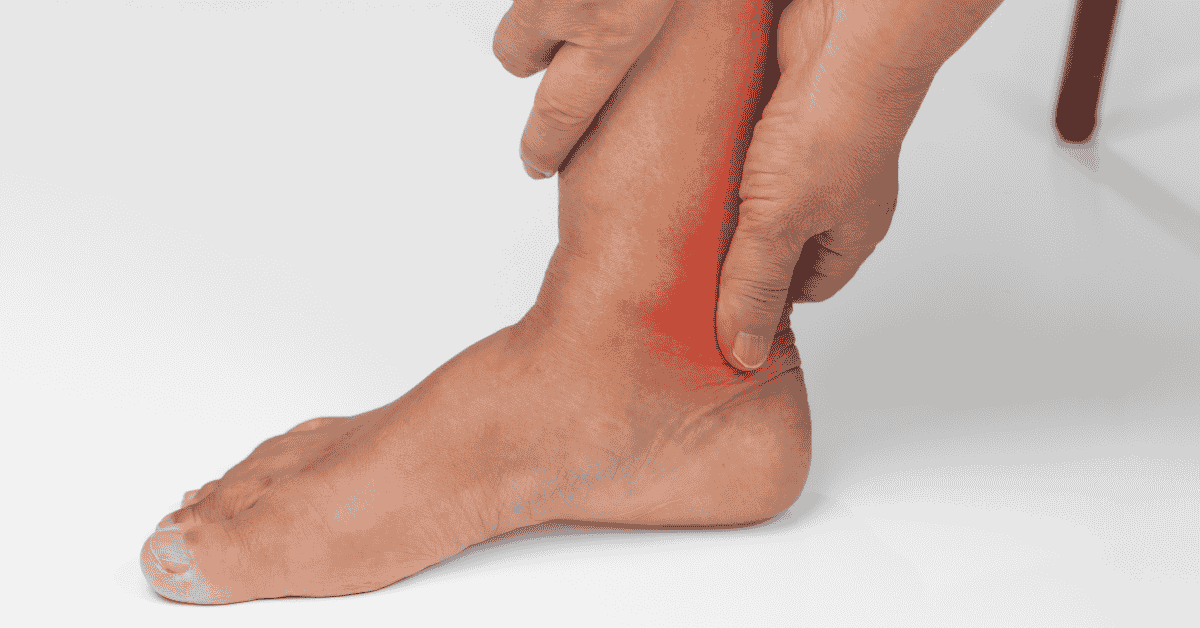 Why Your Heel Pain Isn’t “Just Plantar Fasciitis” — And What It Could Actually Be