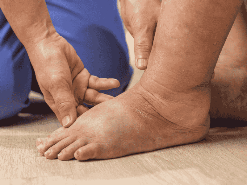 Diabetes & Your Feet: The Silent Warning Signs You Should Never Ignore