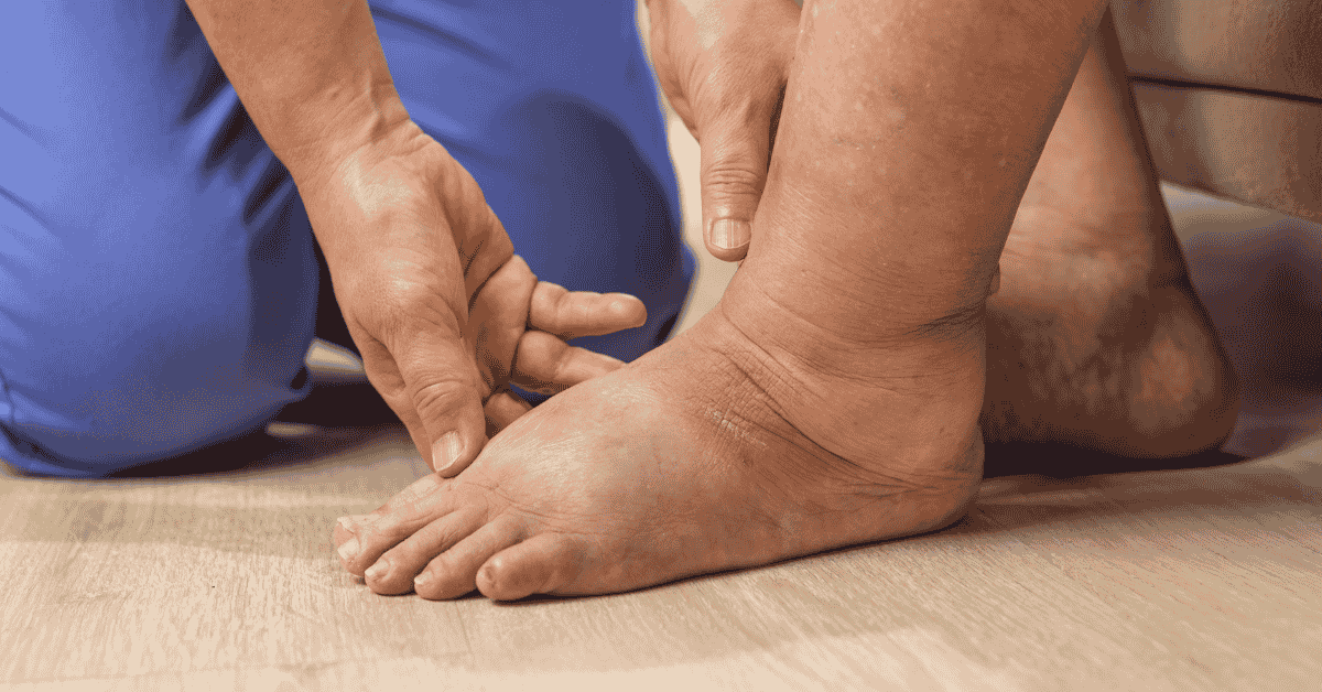 Diabetes & Your Feet: The Silent Warning Signs You Should Never Ignore