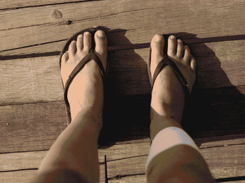 Flip-Flops in Arizona: Harmless Habit or Hidden Foot Damage?