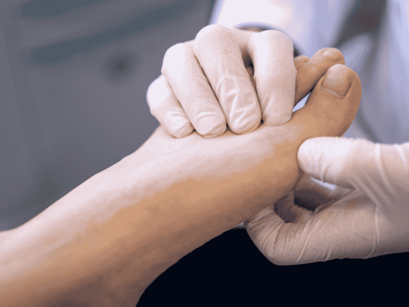 Why Foot Pain Comes Back: The Real Reason Treatments Sometimes Fail